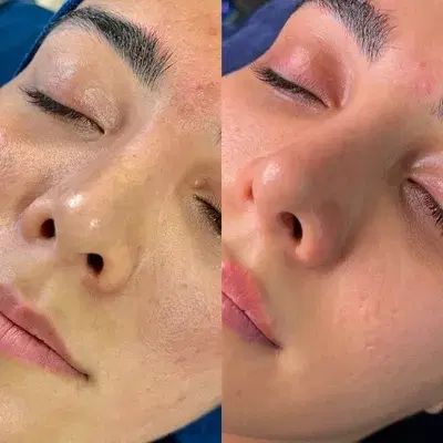 پاکسازی و فیشال میکاپ شینیون و کاشت مژه ورنگ|خدمات آرایشگری و زیبایی|مشهد, رسالت|دیوار
