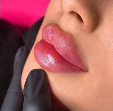 کلینیک تزریق ژل و بوتاکس .فیلر زیر چشم . آنزیم|خدمات آرایشگری و زیبایی|کرج, گوهردشت|دیوار