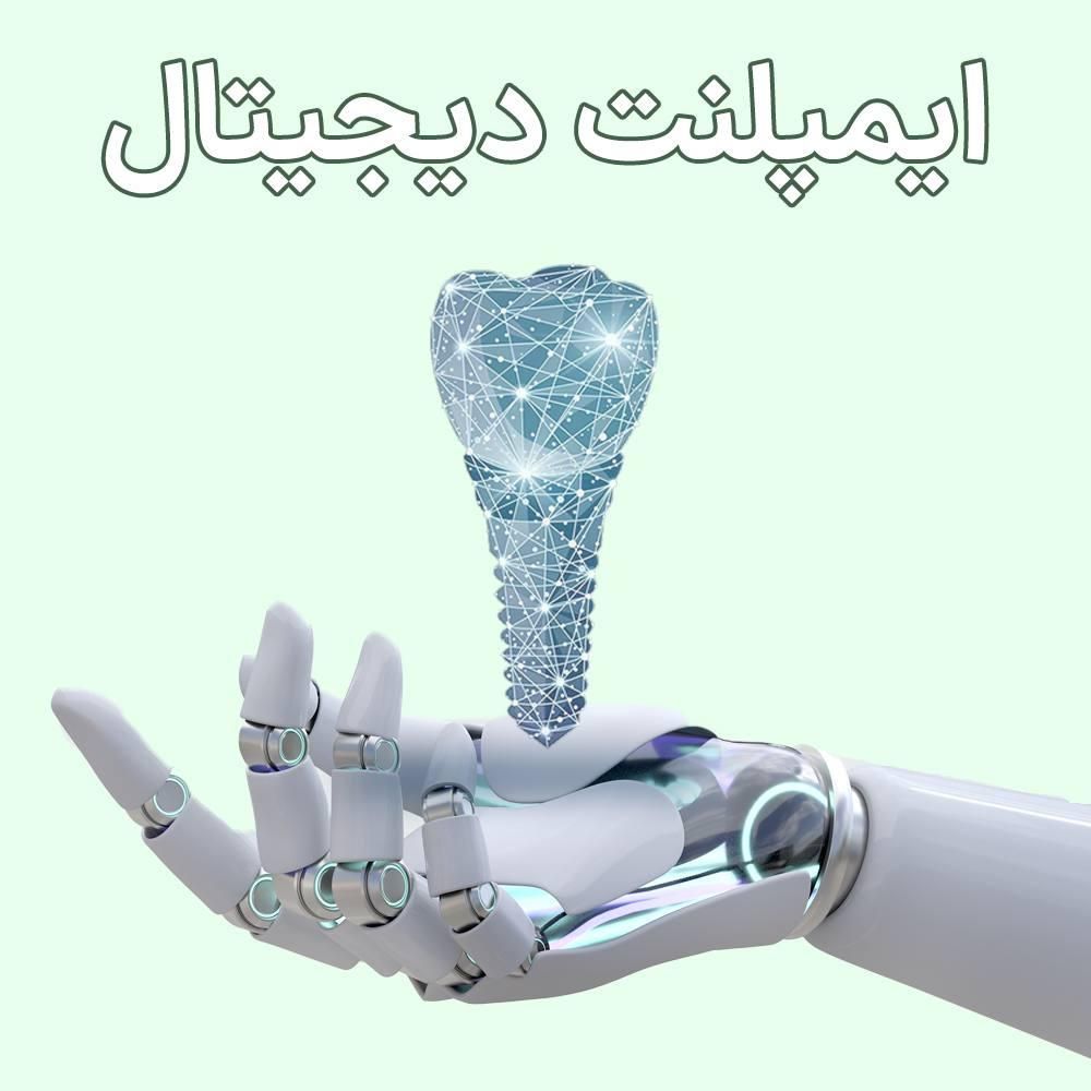 ایمپلنت فقط ۷ میلیون و ۸۰۰/ضمانتی/اقساطی|خدمات آرایشگری و زیبایی|اصفهان, نقش جهان|دیوار