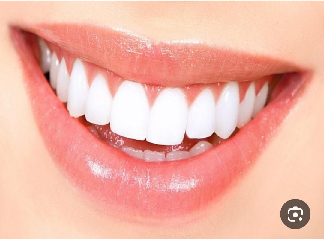 جرم گیری و بروساژ|خدمات آرایشگری و زیبایی|تهران, علم و صنعت|دیوار