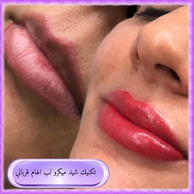 میکروبلیدینگ فیبروز شیدلب بنمژه ریموو|خدمات آرایشگری و زیبایی|شیراز, کوی زهرا|دیوار