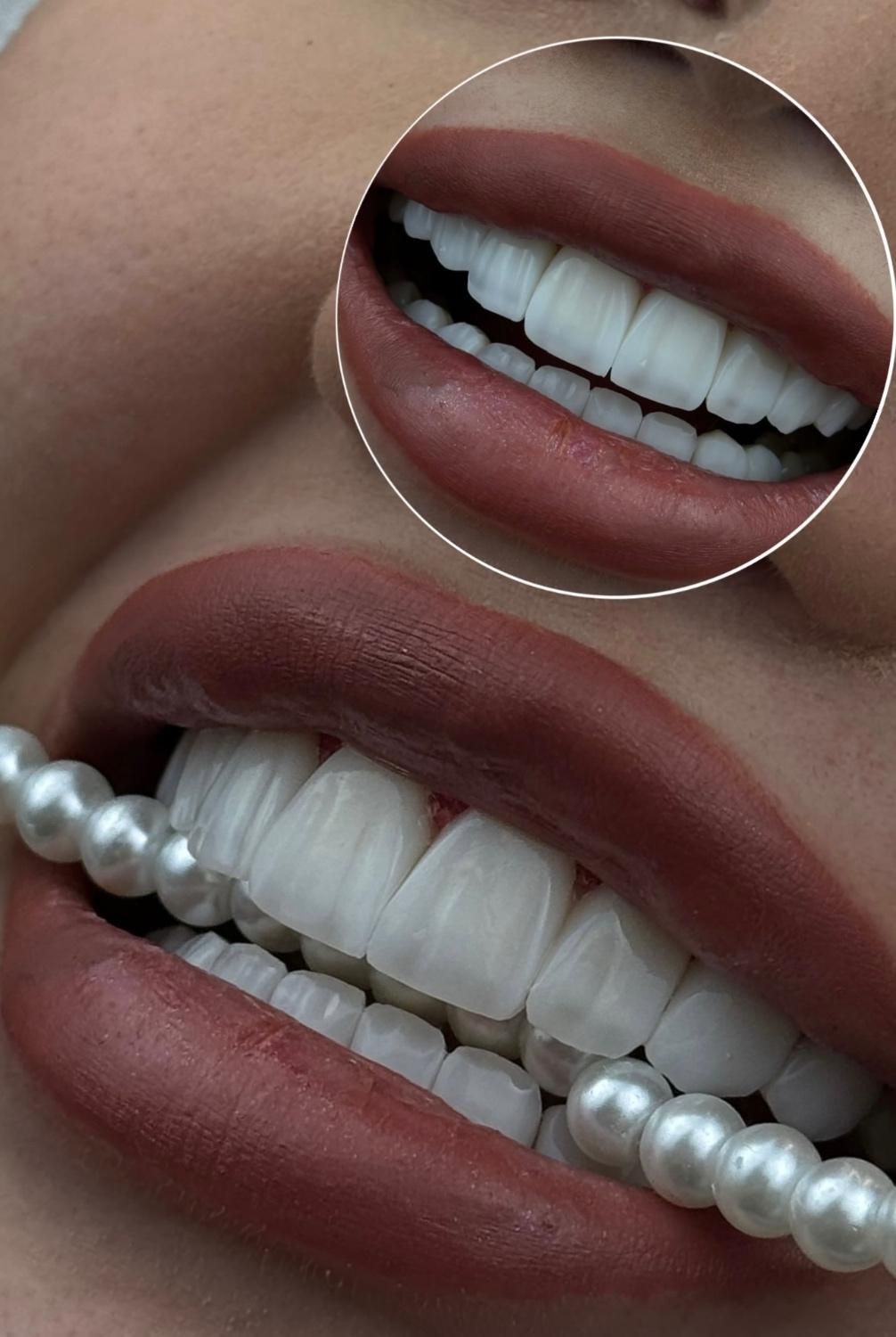 دندان پزشکی/لمینیت/ارتودنسی/کامپوزیت/ایمپلنت|خدمات آرایشگری و زیبایی|مشهد, چهارچشمه|دیوار