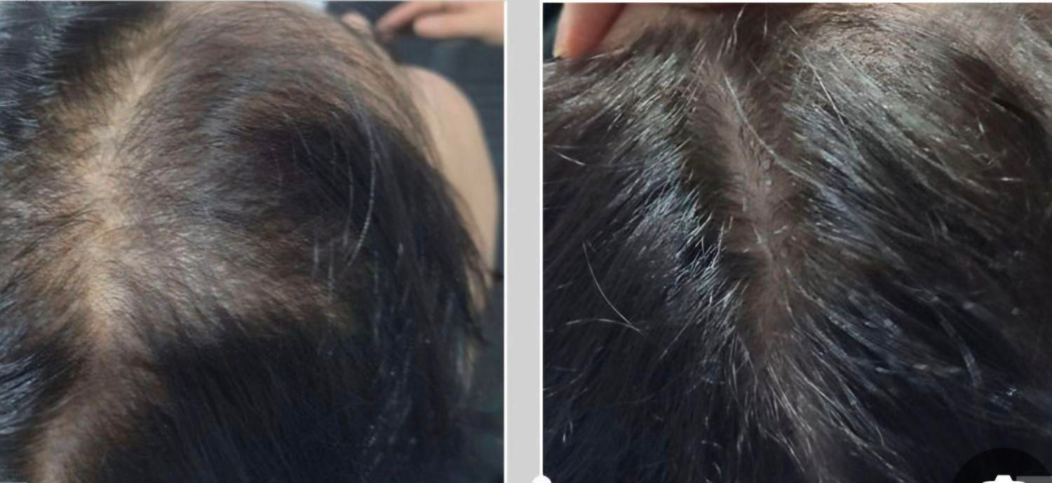 تزریق ژل،بوتاکس،سابسیژن،پی آرپی،مطب درمانی وزیبایی|خدمات آرایشگری و زیبایی|خرم‌آباد, |دیوار