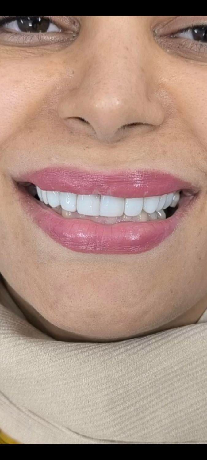 خدمات دندانپزشکی با قیمت مناسب|خدمات آرایشگری و زیبایی|گنبد کاووس, |دیوار