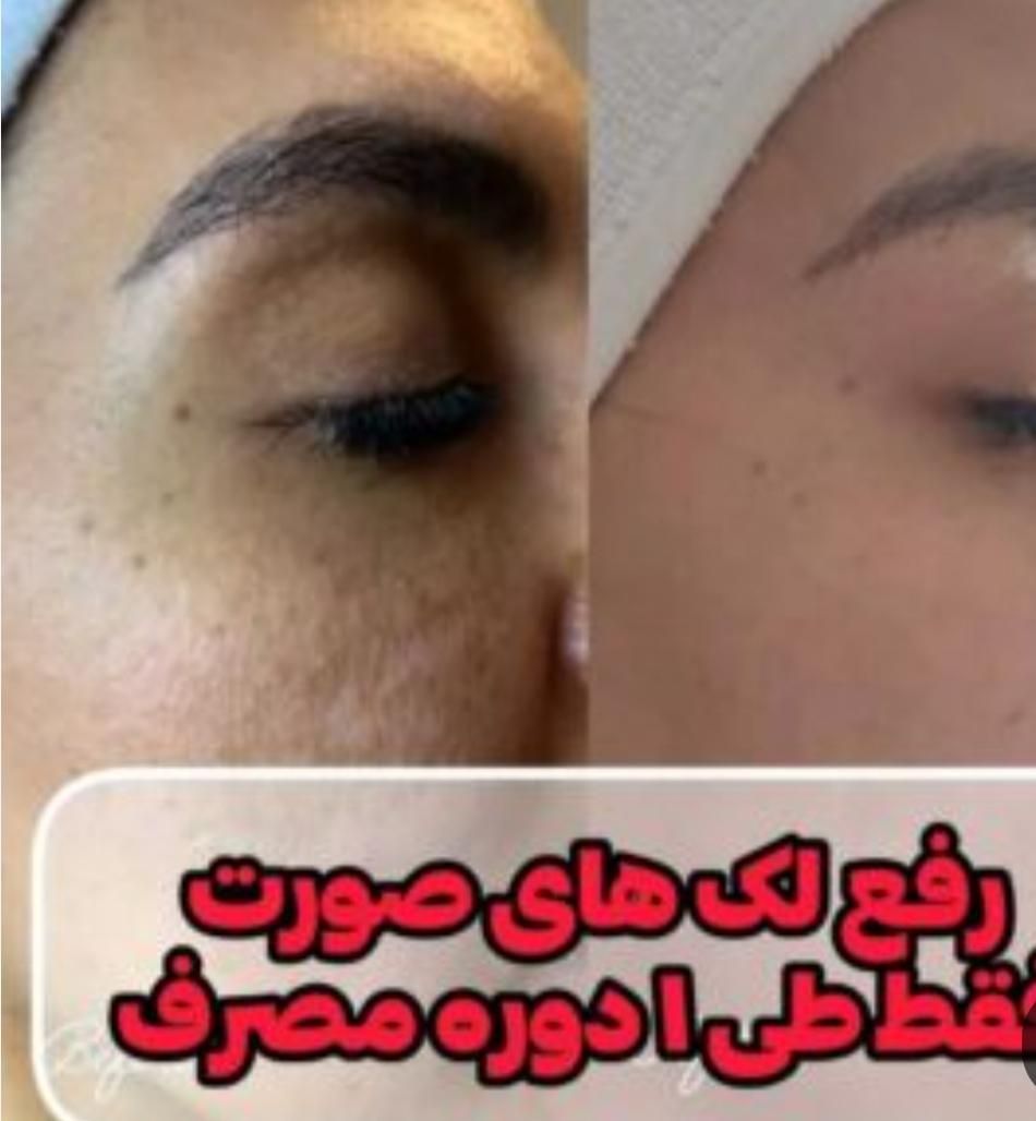 محصولات برندضد لک  ضد چروک  ضد آفتاب و آبرسان قوی|آرایشی، بهداشتی، درمانی|اصفهان, شاهزید|دیوار