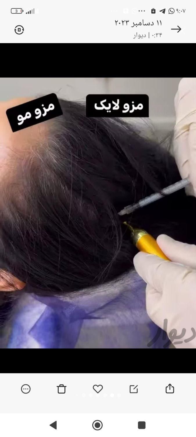 ژل بوتاکس لیزر مزو پی آر پی خالیرداری جوانسازی|خدمات آرایشگری و زیبایی|تهران, افسریه|دیوار