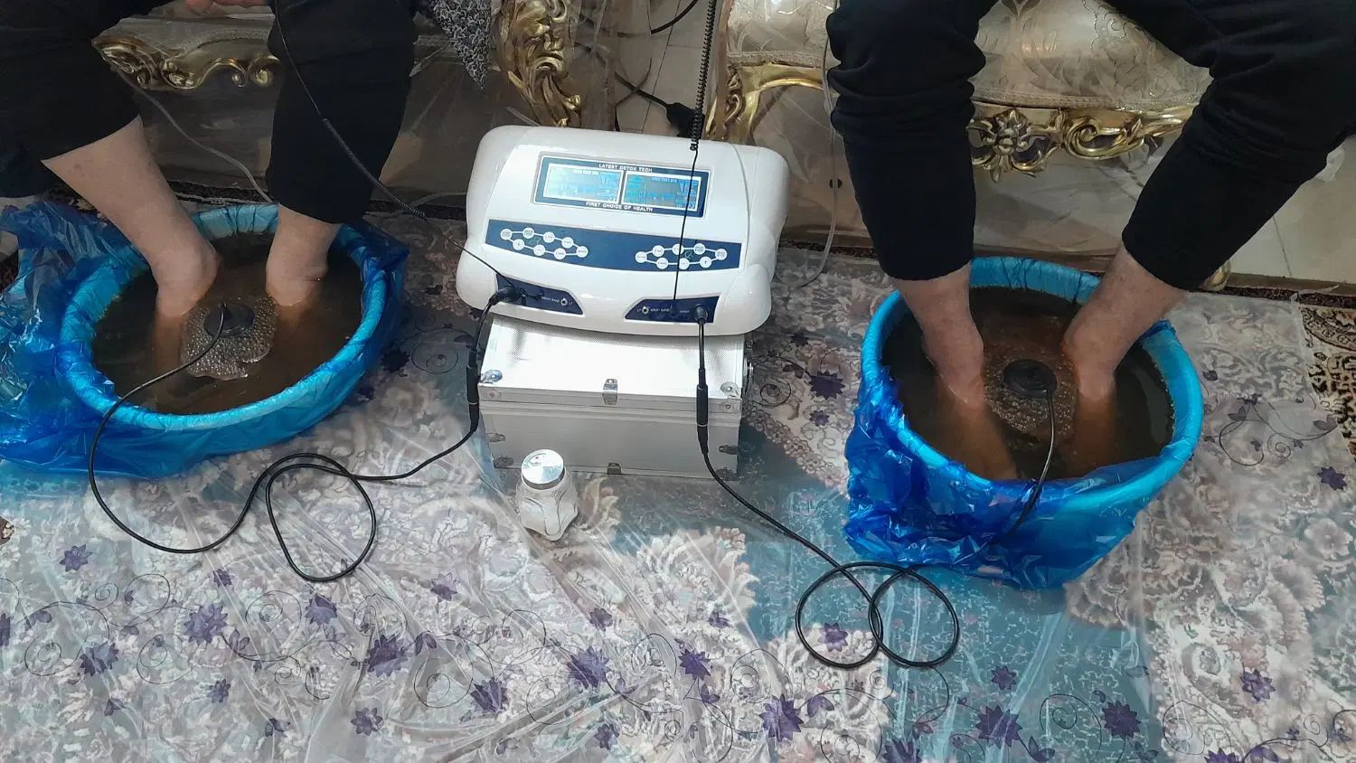 سم زدای یون تراپی حجامت بادکش رگ گیری|خدمات آرایشگری و زیبایی|مشهد, شهرک امام هادی (شهرک غرب)|دیوار