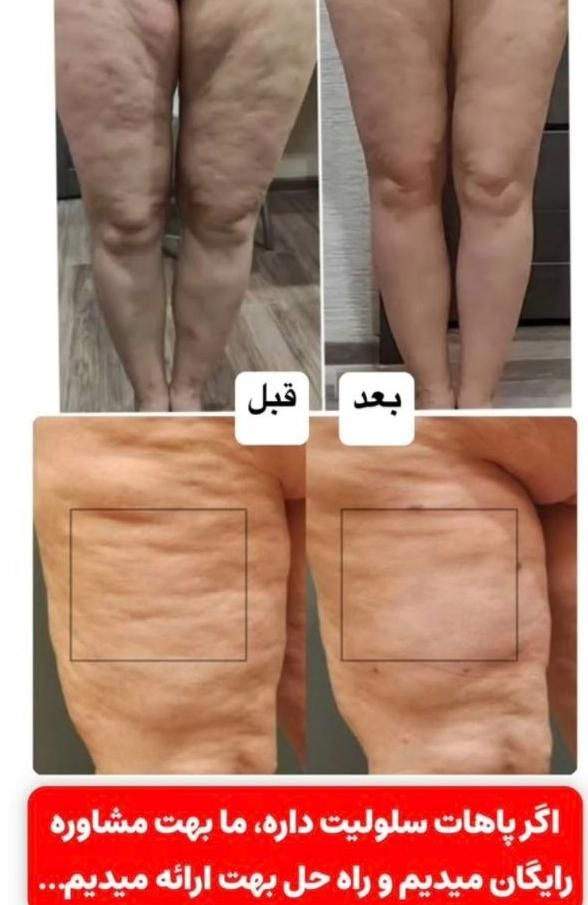 لاغری، تناسب اندام و لیزر در یک مرکز تخصصی|خدمات آرایشگری و زیبایی|کرج, مهرویلا جنوبی|دیوار