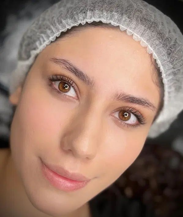مرکزتخصصی میکروفیبروز بنمژه شیدوتینت لب بدون بیحسی|خدمات آرایشگری و زیبایی|مشهد, فلسطین|دیوار