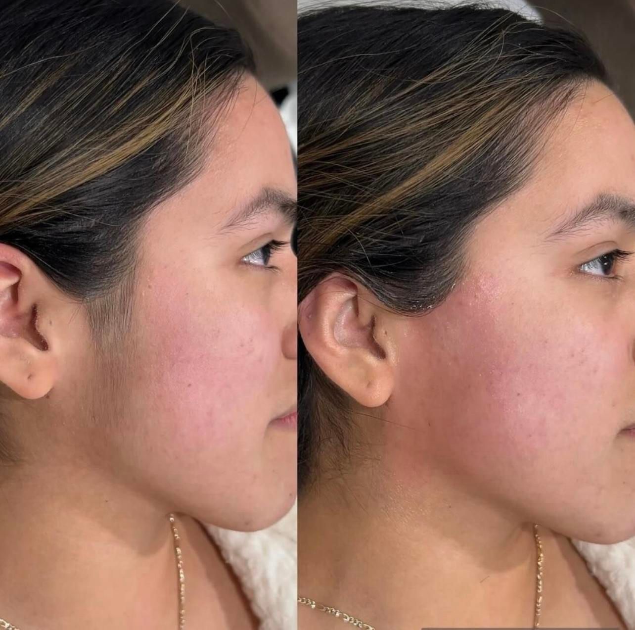 کلینیک لیزر موهای زائد|خدمات آرایشگری و زیبایی|خمینیشهر, |دیوار