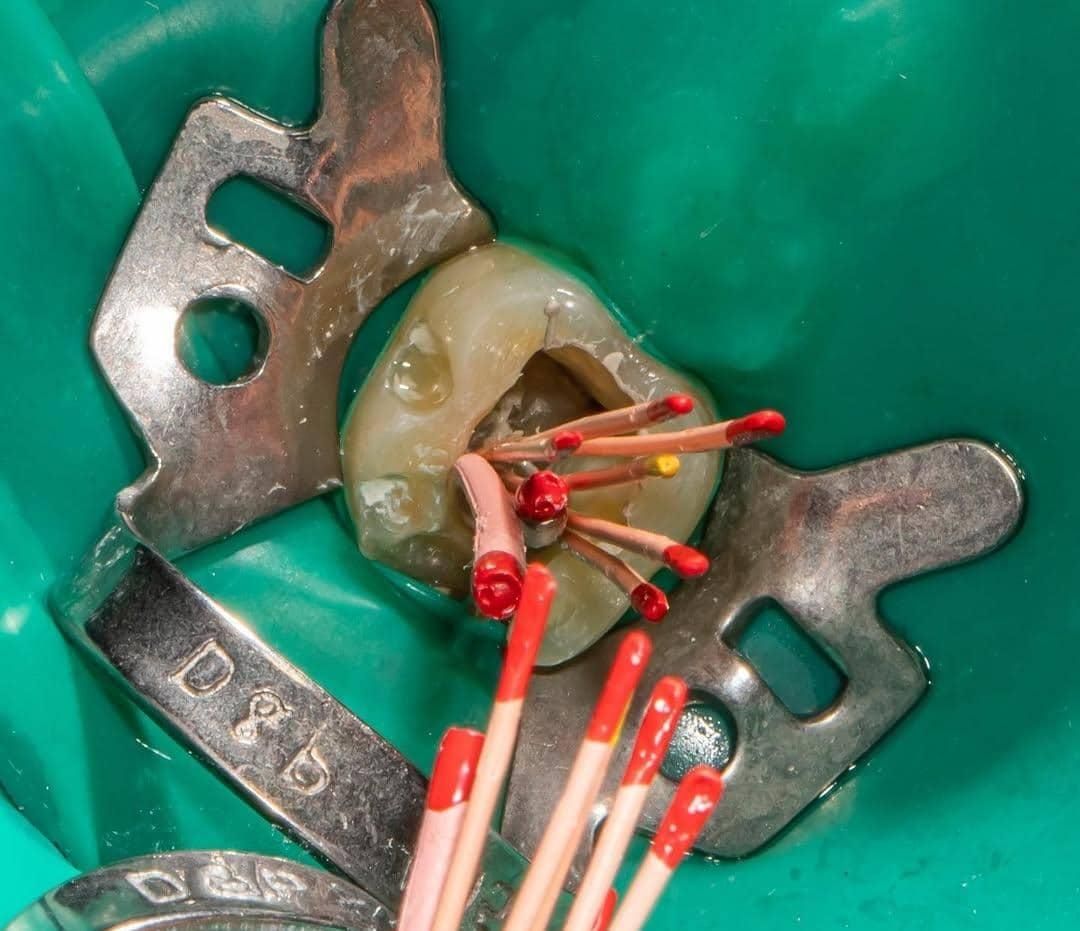 خدمات درمانی دندان پزشکی|خدمات آرایشگری و زیبایی|قم, چهار مردان|دیوار