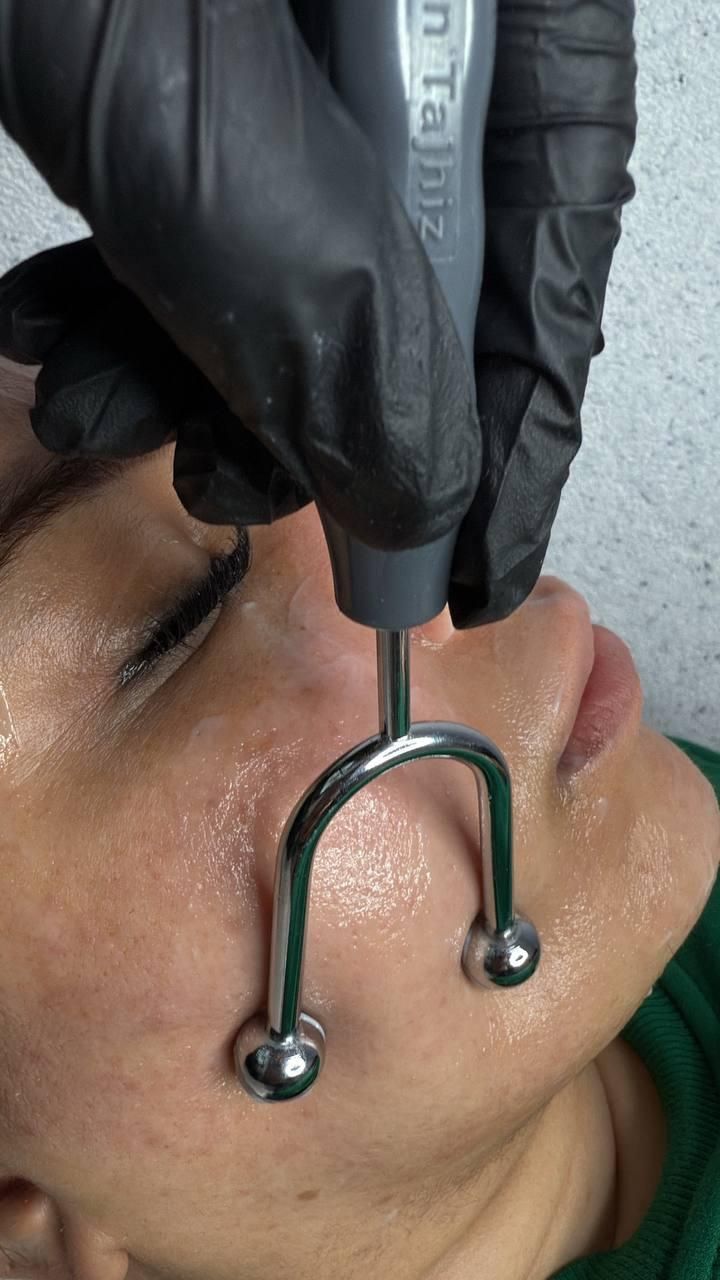 فیشال و پاکسازی پوست|خدمات آرایشگری و زیبایی|تهران, ابوذر|دیوار