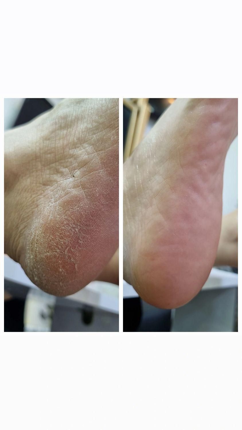 پدیکور و کف سابی|خدمات آرایشگری و زیبایی|رشت, بوسار|دیوار