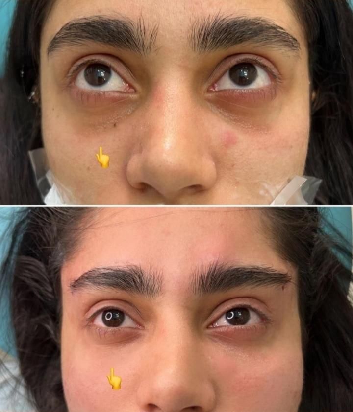 کلینیک تزریق ژل بوتاکس فیلر زیرچشم هایفولیزر انزیم|خدمات آرایشگری و زیبایی|کرج, گوهردشت|دیوار
