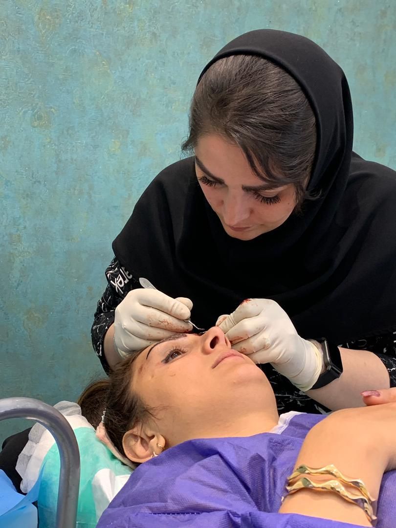 کاشت ابرو کاشت شقیقه توسط استادواموزش|خدمات آرایشگری و زیبایی|تبریز, |دیوار