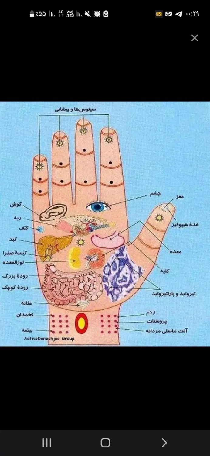 دست(درمان بیحسی.لرزش.ضعف )|خدمات آرایشگری و زیبایی|نیشابور, شهرک قدس|دیوار