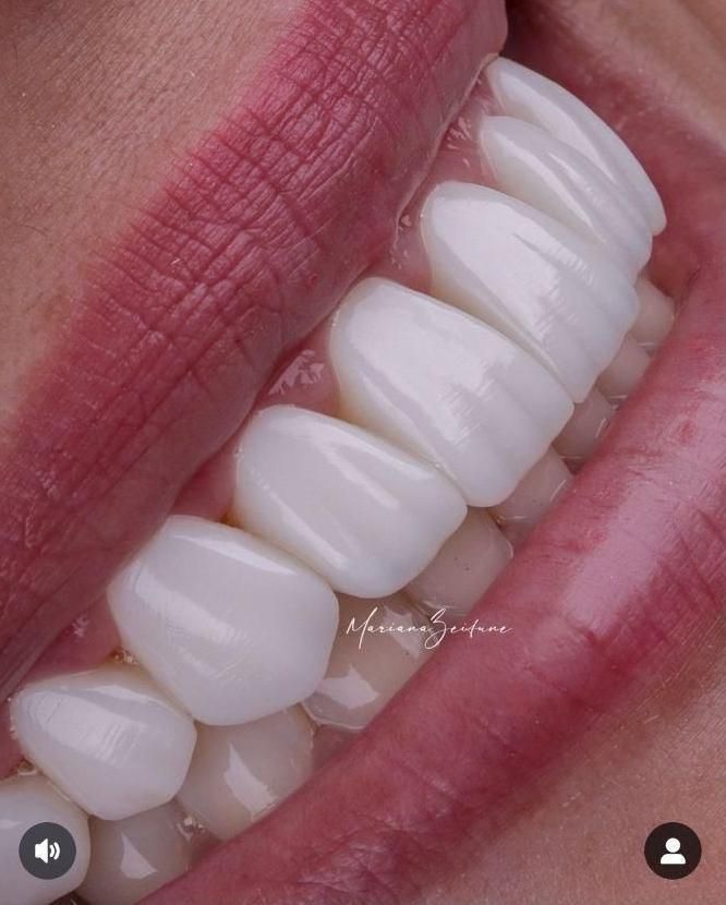 دندانسازی|خدمات آرایشگری و زیبایی|آباده, |دیوار