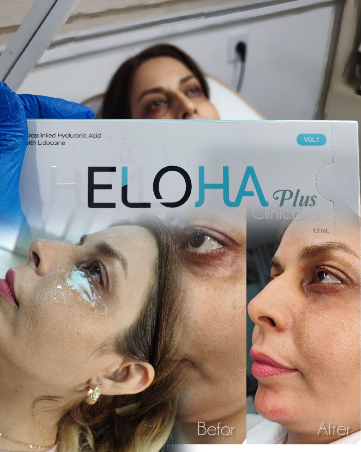 مرکززیبایی و لیزر آکو|خدمات آرایشگری و زیبایی|اندیمشک, |دیوار