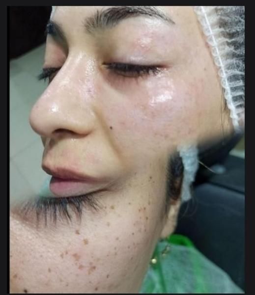 ازبین بردن کک ومک تضمینی در یک جلسه|خدمات آرایشگری و زیبایی|گالیکش, |دیوار