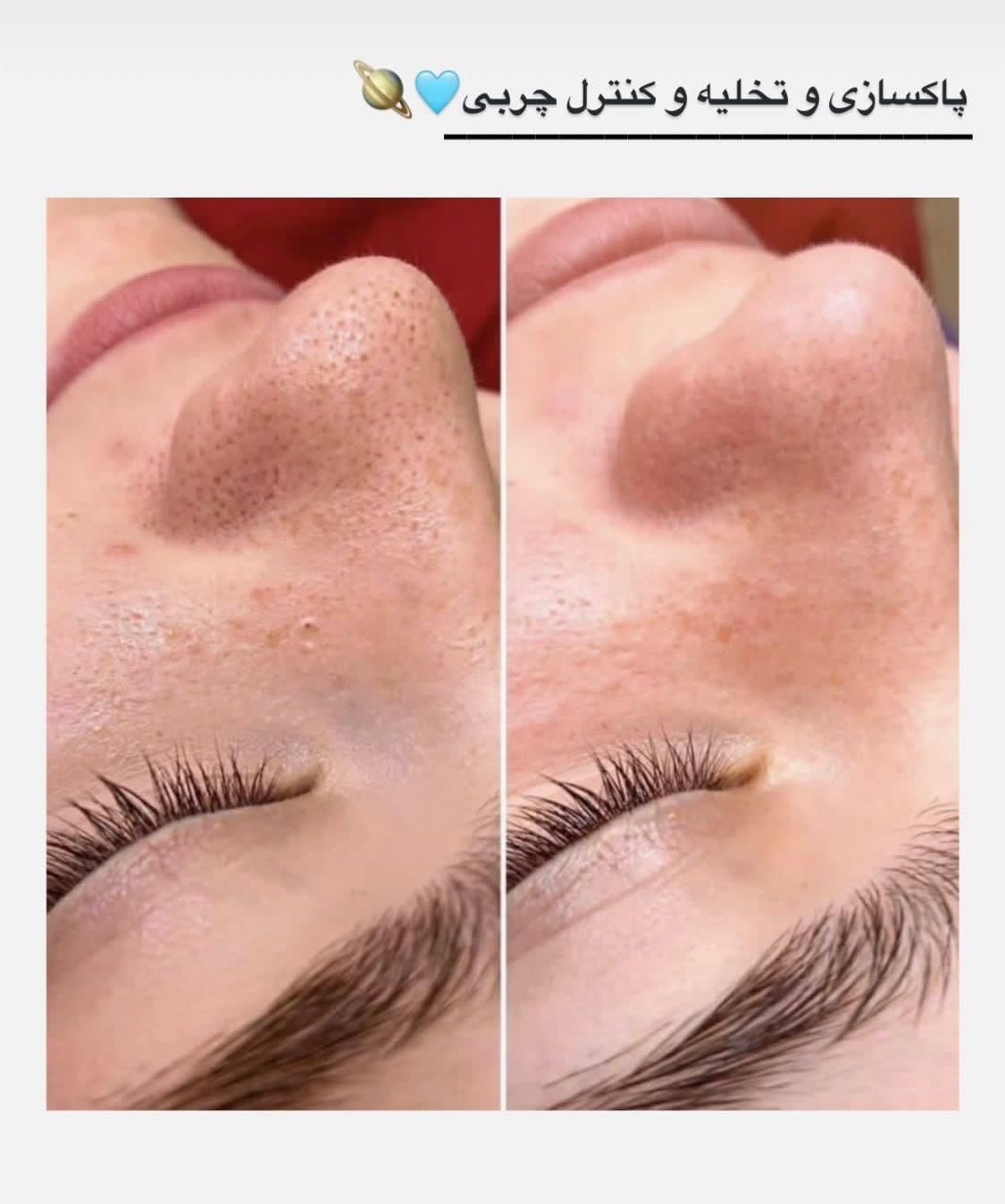 اخرین جایی ک برای پوستت میری اینجاست|خدمات آرایشگری و زیبایی|تهران, قلهک|دیوار