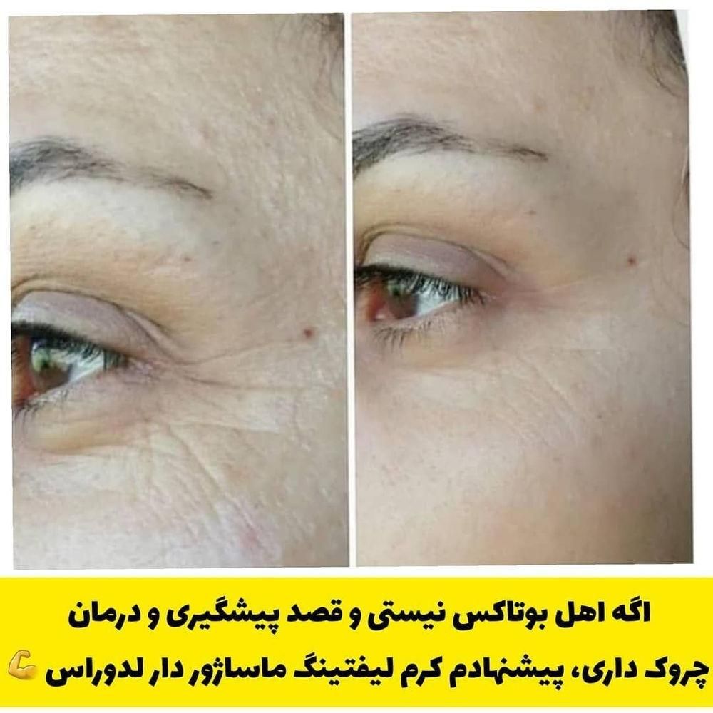 تنها کرم لیفت صورت(نمایندگی رسمی لاکچری کوین)|آرایشی، بهداشتی، درمانی|تهران, ابن بابویه|دیوار