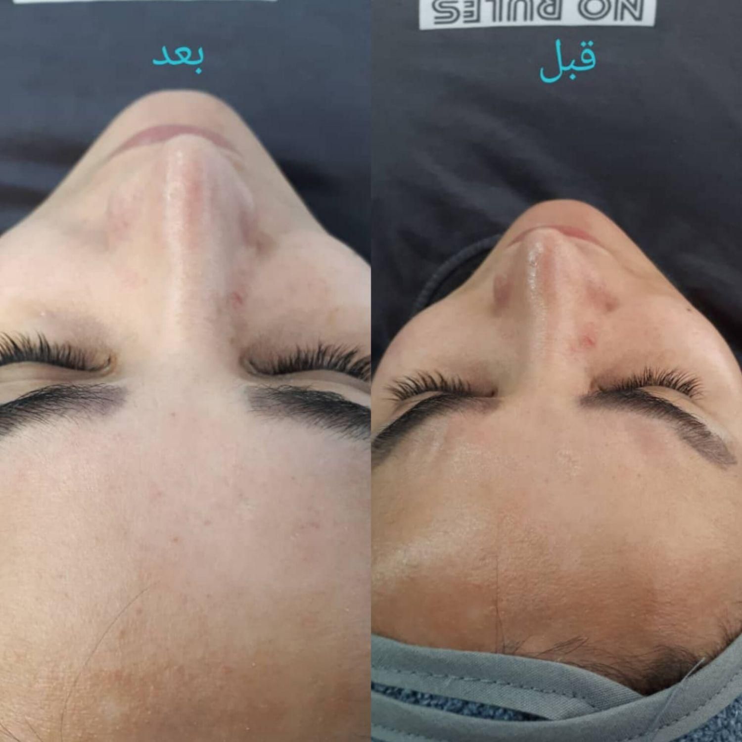 آموزشگاه مراقبت و زیبایی شاپرک|خدمات آموزشی|گرگان, |دیوار