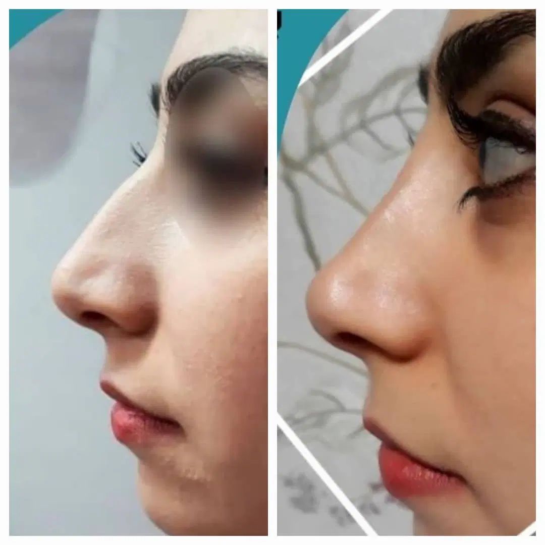 کلینیک تخصصی زیبایی لاغری کاشت ابرو مو بلفارو|خدمات آرایشگری و زیبایی|قم, زنبیل آباد|دیوار