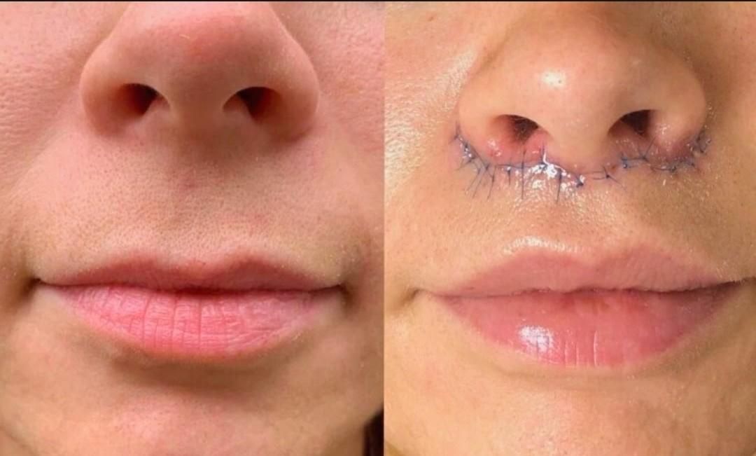 جشنواره تخفیفات ویژه عملهای زیبایی پلک و بینی و ..|خدمات آرایشگری و زیبایی|شیراز, زرگری|دیوار
