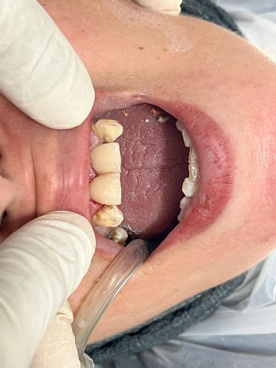 خدمات دندانپزشکی  با  قیمت و شرایط پرداخت عالی|خدمات آرایشگری و زیبایی|رشت, دروازه لاکان|دیوار
