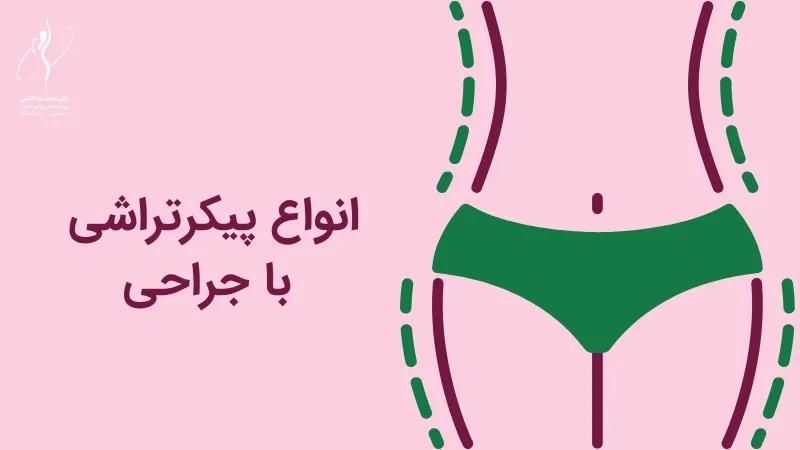 جشنواره اقساطی عمل بینی، لیپو، ابدو، پیکر تراش|خدمات آرایشگری و زیبایی|اصفهان, ملکشهر|دیوار