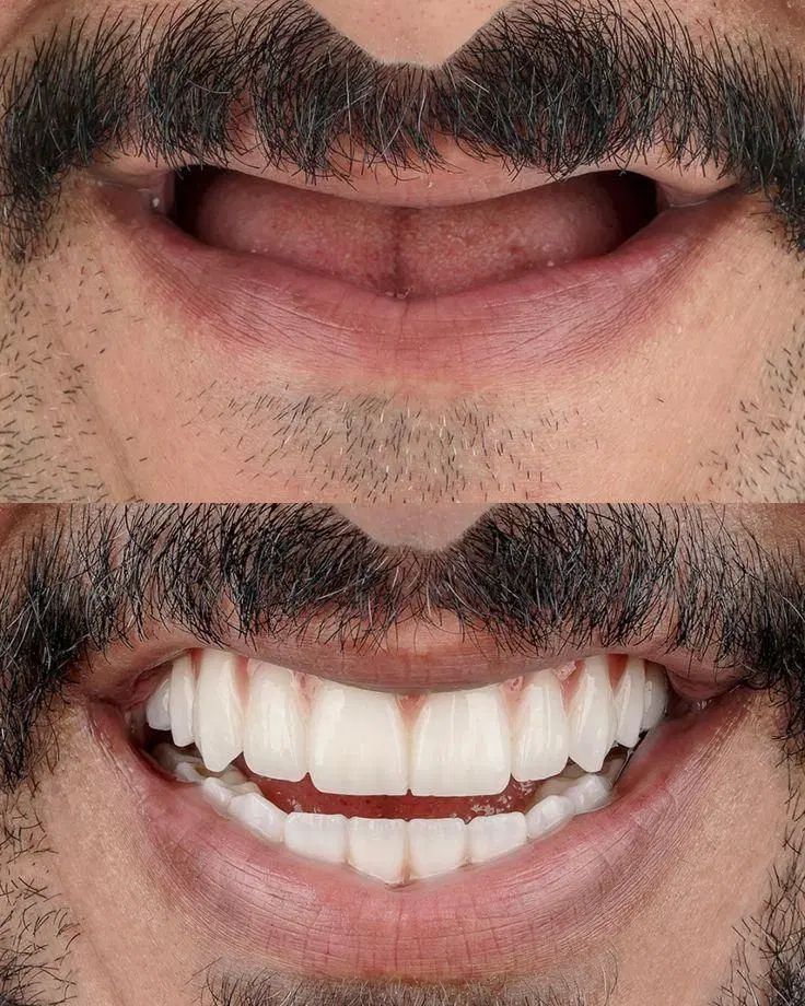 دندانپزشکی ایمپلنت اقساط ۲۴ ماهه|خدمات آرایشگری و زیبایی|تهران, میرداماد|دیوار