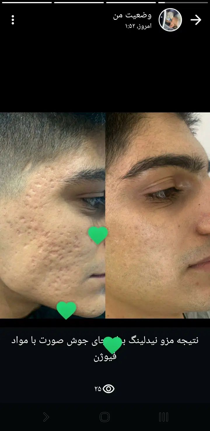 خدمات تخصصی پوست|خدمات آرایشگری و زیبایی|کرج, کوی کارمندان جنوبی|دیوار
