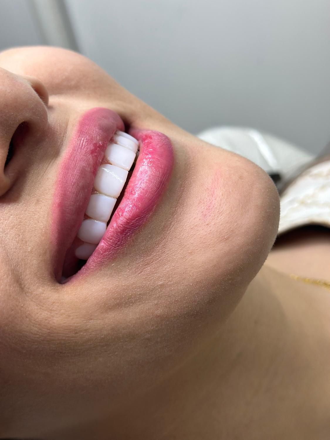 کامپوزیت دندان جشنواره|خدمات آرایشگری و زیبایی|تهران, فردوسی|دیوار