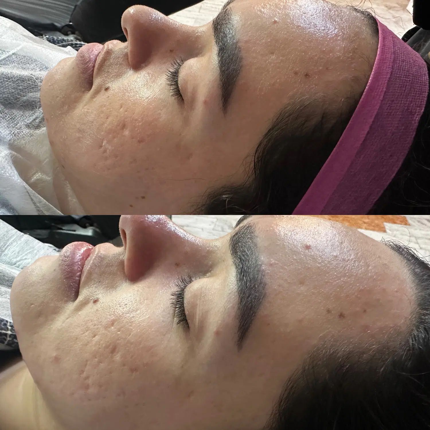 فیشال‌فیشیال‌پاکسازی‌پوست‌کربوکسی‌اسیدتراپی‌اموزش‌|خدمات آرایشگری و زیبایی|مشهد, شهید معقول|دیوار