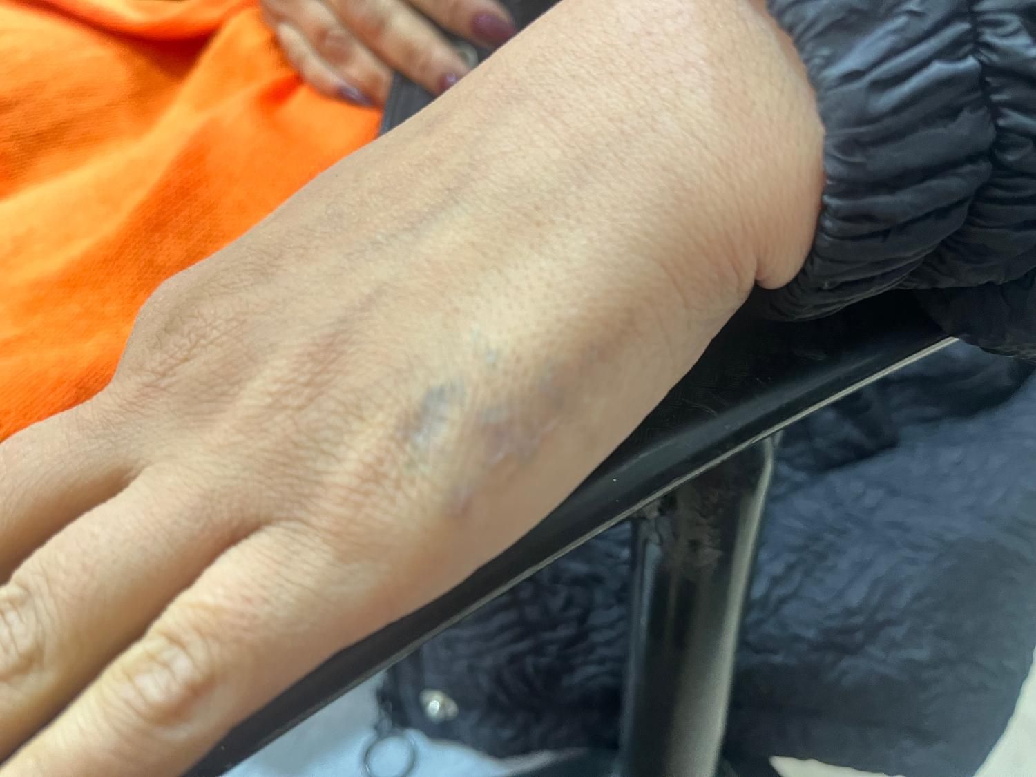 پاک کردن تتوخالکوبی/بدن ابرو لب چشم/بوتاکس کیوسویچ|خدمات آرایشگری و زیبایی|اصفهان, عباسآباد|دیوار