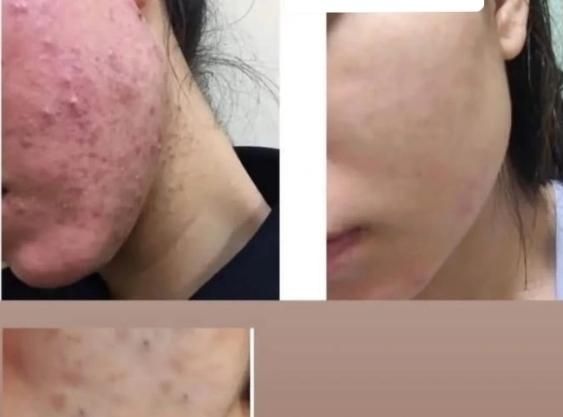 پاکسازی وفیشیال تخصصی پوست خانمهاوآقایون|خدمات آرایشگری و زیبایی|بهبهان, |دیوار