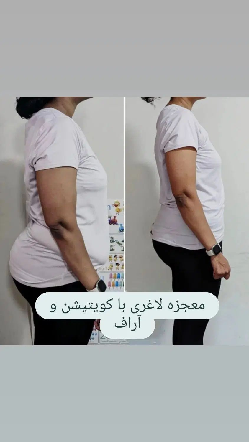 ۳ سوت لاغری فوری با کویتیشن آر‌اف و وکیوم|خدمات آرایشگری و زیبایی|مشهد, الهیه|دیوار