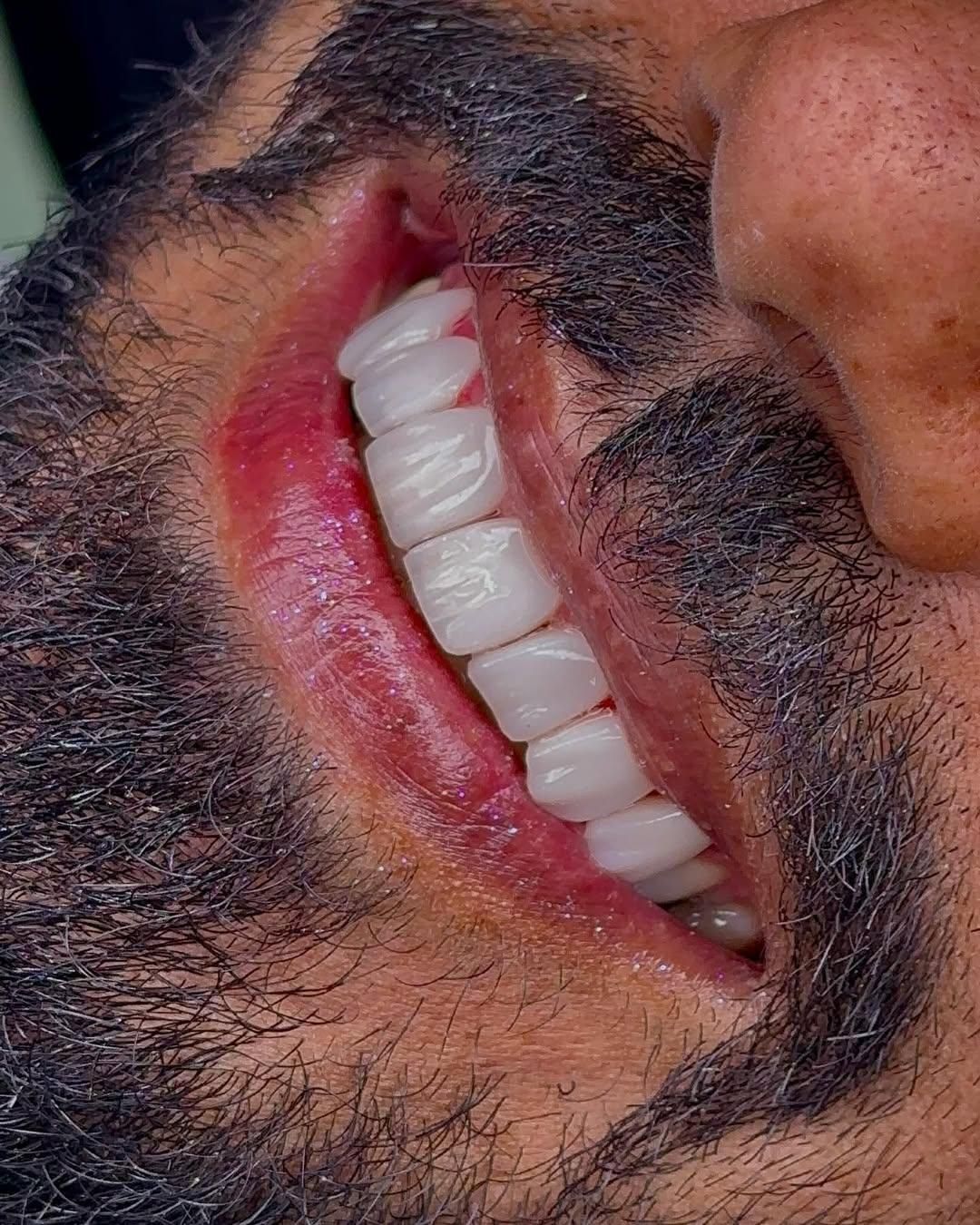 مطب دندانپزشکی الماس|استخدام درمانی، زیبایی، بهداشتی|تهران, عبدل‌آباد|دیوار