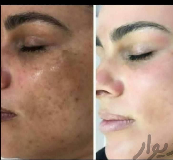 کرم معجزه 43ترکیبه کلاژن گیاهی سفید کنندگی قوی|آرایشی، بهداشتی، درمانی|شیراز, سلطان آباد|دیوار