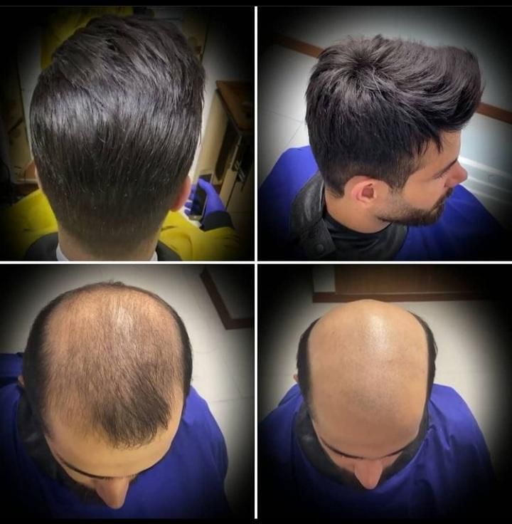 مرکز فوق تخصصی ترمیم مو|خدمات آرایشگری و زیبایی|اصفهان, کشاورزی|دیوار