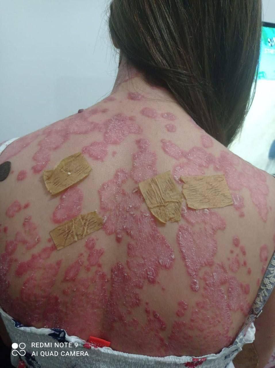 درمان بیماریها به روش tts|آرایشی، بهداشتی، درمانی|اصفهان, فرح آباد|دیوار