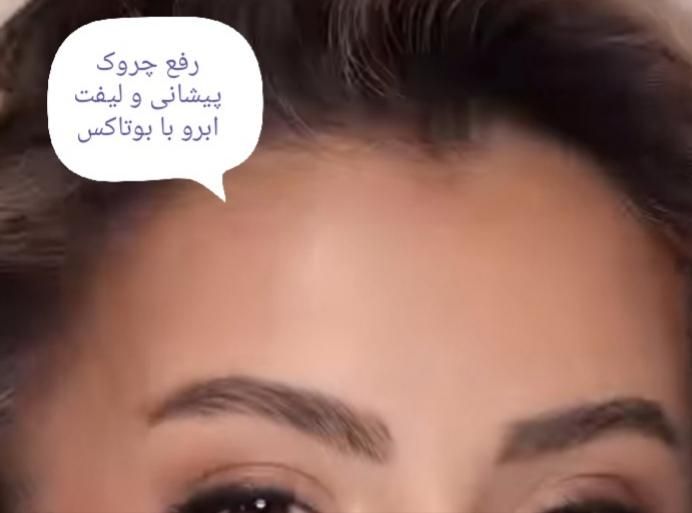 تزریق بوتاکس و ژل در کلینیک(توسط پزشک،)|خدمات آرایشگری و زیبایی|مشهد, هفت تیر (آب و برق)|دیوار