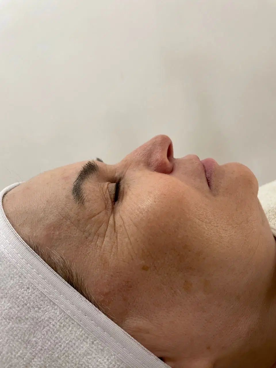 برای اولین بار درقزوین شبه بوتاکس بدون تزریق|خدمات آرایشگری و زیبایی|قزوین, |دیوار