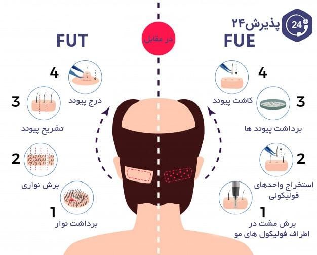 کاشت مو/پیوند مو/کاشت ابرو/کاشت ریش|خدمات آرایشگری و زیبایی|شیراز, وحدت|دیوار