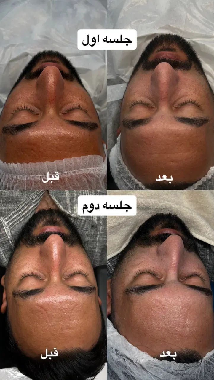 تخفیف آموزش و خدمات فیشال تخصصی بانوان و آقایان|خدمات آرایشگری و زیبایی|مشهد, کوثر|دیوار