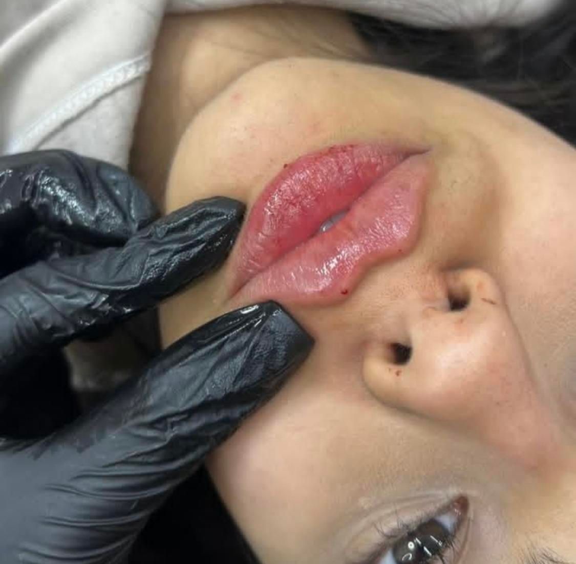 کلینیک تزریق ژل جالپرو لیزر بوتاکس۴۹۰ زاویه پزشک|خدمات آرایشگری و زیبایی|تهران, صادقیه|دیوار