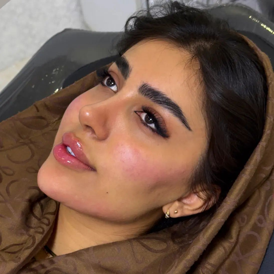 معماری صورت با فیلر/بوتاکس/پی ارپی/سلول های بنیادی|خدمات آرایشگری و زیبایی|تبریز, |دیوار