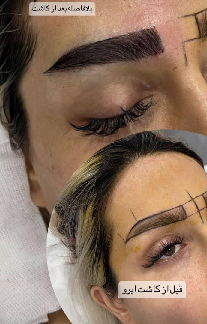 کاشت ابرو طبیعی و حرفه ای در کلینیک معتبر|خدمات آرایشگری و زیبایی|تهران, سهروردی|دیوار