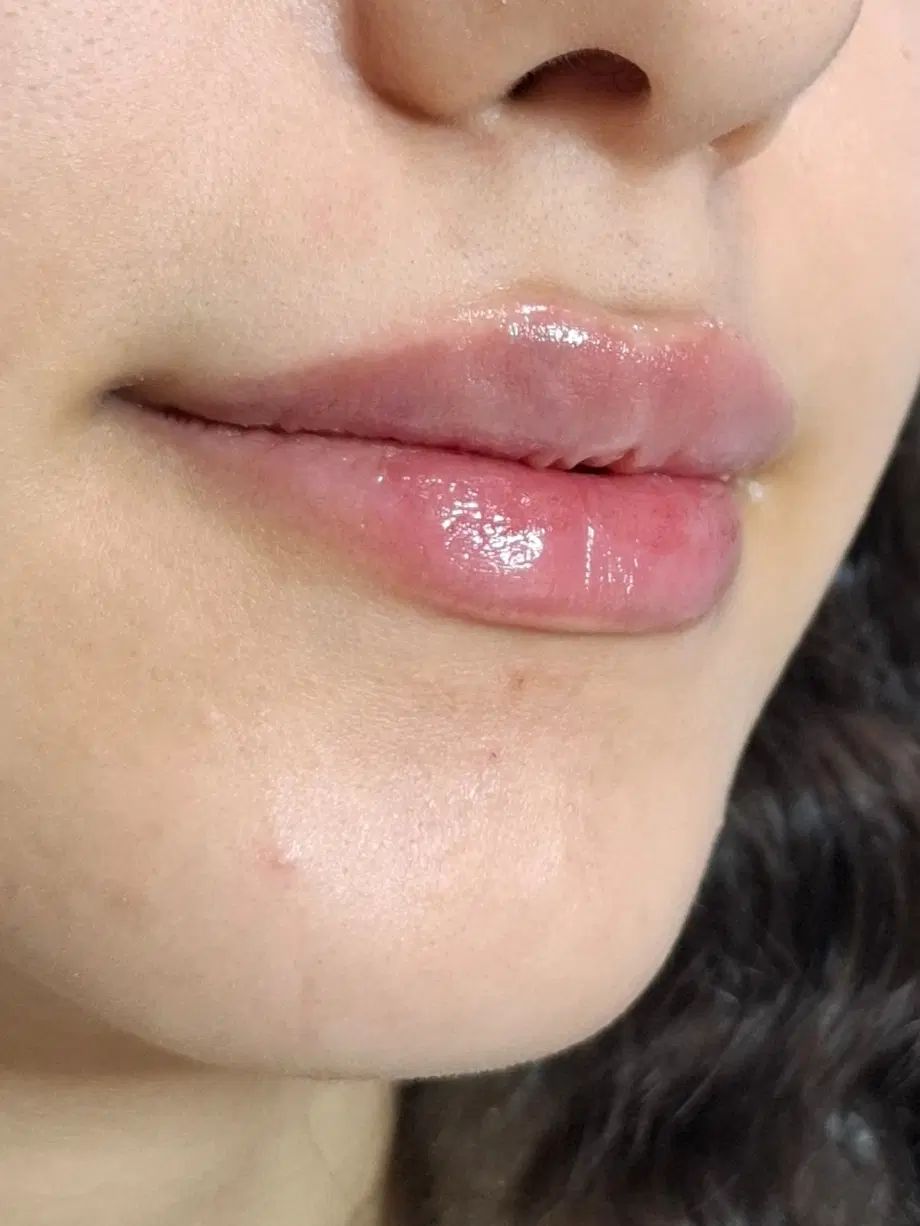 فیلر لب نچرال|خدمات آرایشگری و زیبایی|رشت, بلوار گیلان|دیوار