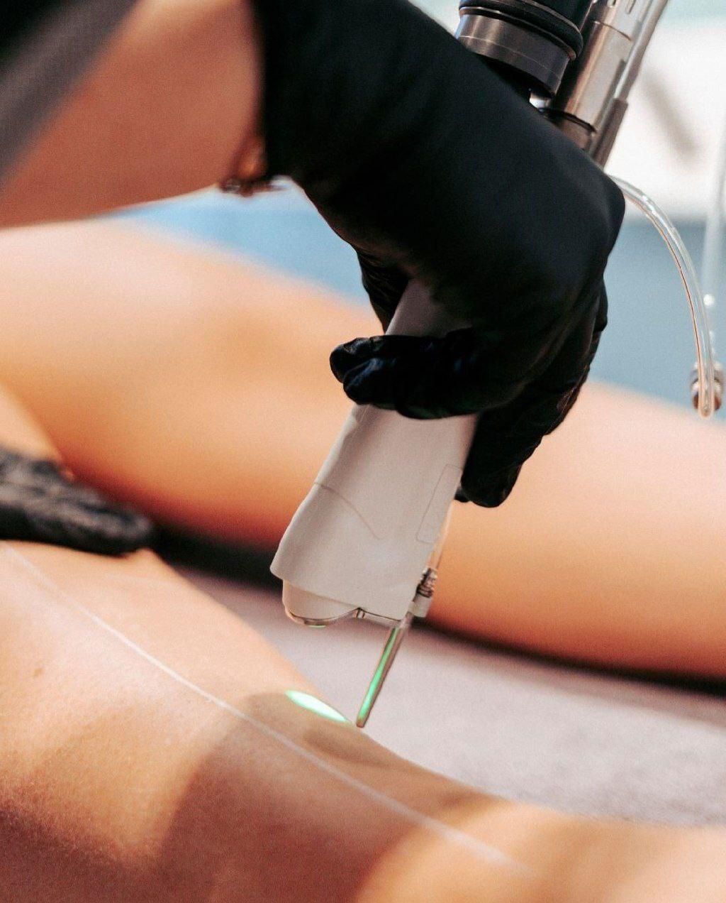 لیزر الکساندرایت غیر تماسی شاتی|خدمات آرایشگری و زیبایی|مشگین شهر, |دیوار